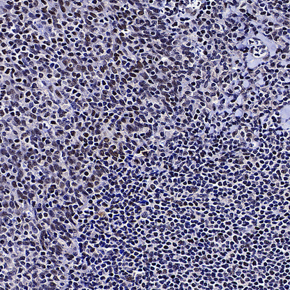 TOP2B Recombinant Rabbit mAb (S-4452-44)