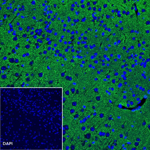 Vesicular Glutamate Transporter 1 (VGLUT1) Recombinant Rabbit mAb (S-1118-58)