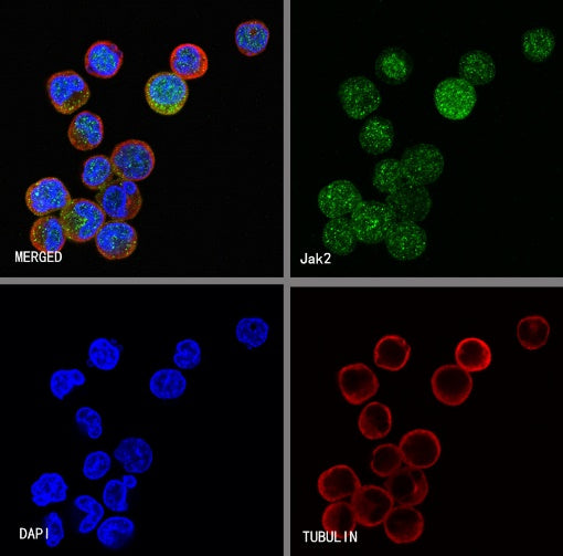 Jak2 Recombinant Rabbit mAb (S-1316-5)