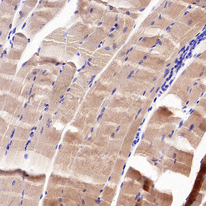 MYH7 Recombinant Rabbit mAb (S-4468-32)