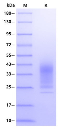 Rat Alpha-1-acid Glycoprotein Protein, His tag
