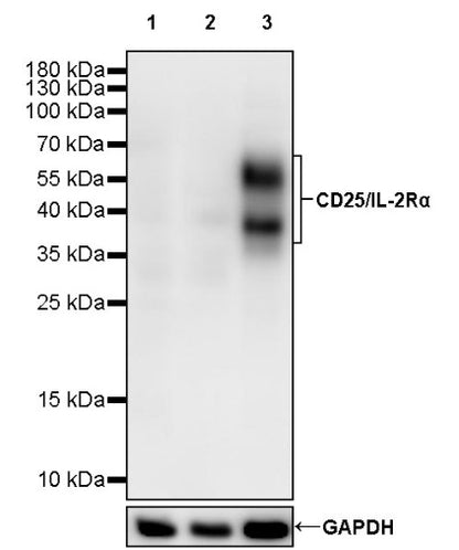 CD25/IL-2Rα Recombinant Rabbit mAb (SDT-2234-65)