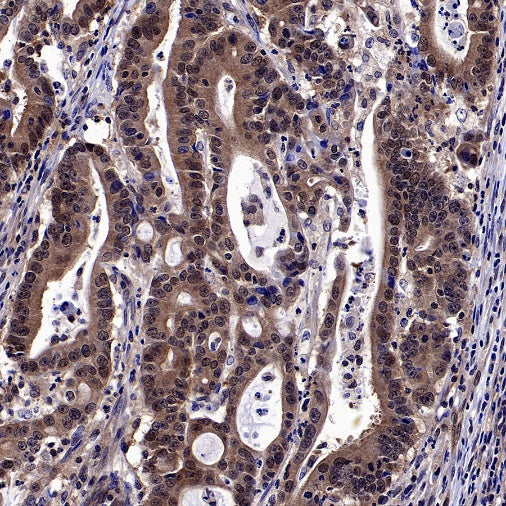 GSDMD Recombinant Rabbit mAb (S-3267)