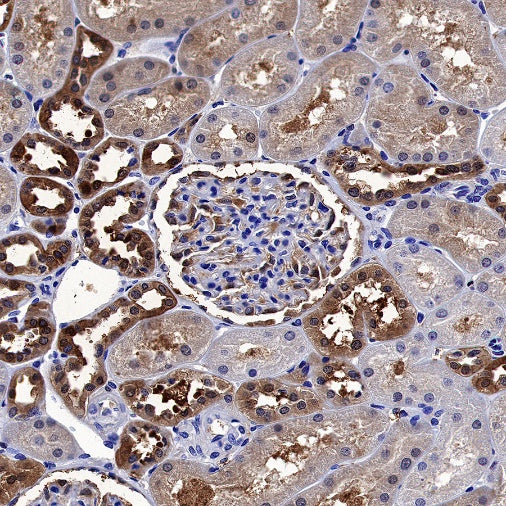 MIF Recombinant Rabbit mAb (S-1007-34)