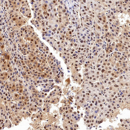 ACLY/ATP citrate lyase Recombinant Rabbit mAb (S-2025-32)