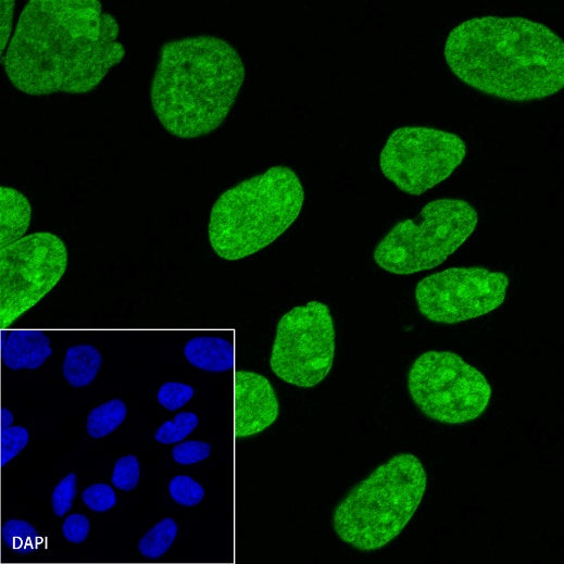 Histone H2B Recombinant Rabbit mAb (S-R214)