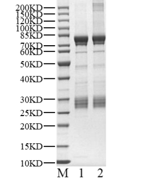 RET (G810R) His&GST Tag Protein, Human