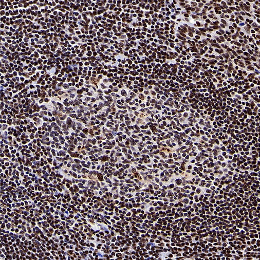 Histone H3 (di+tri methyl K79) Recombinant Rabbit mAb (S-854-48)
