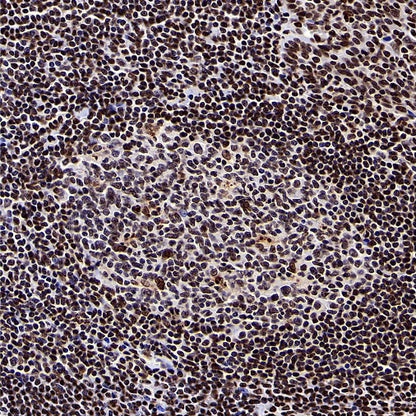 Histone H3 (di+tri methyl K79) Recombinant Rabbit mAb (S-854-48)