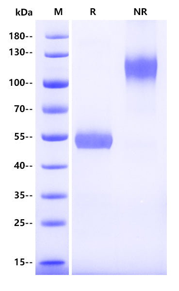 Human CD8 alpha&beta (CD8A&CD8B) Heterodimer Protein, hFc Tag
