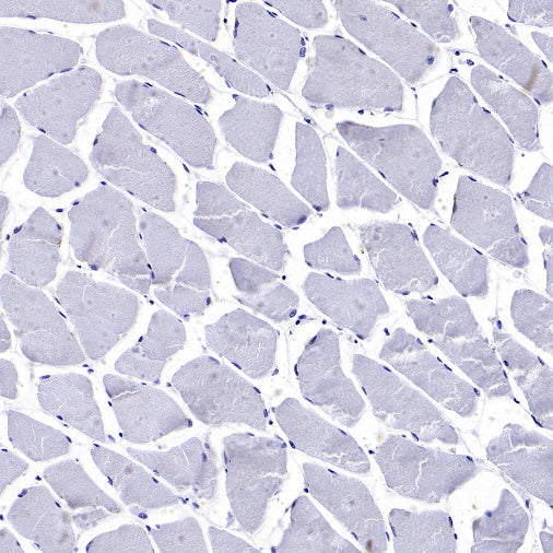 GAP43 Rabbit Polyclonal Antibody-Neuronal Marker