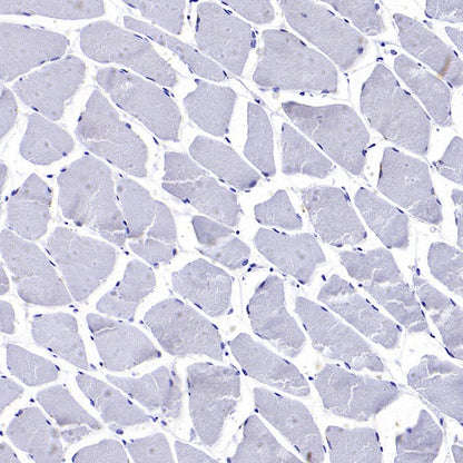 GAP43 Rabbit Polyclonal Antibody-Neuronal Marker