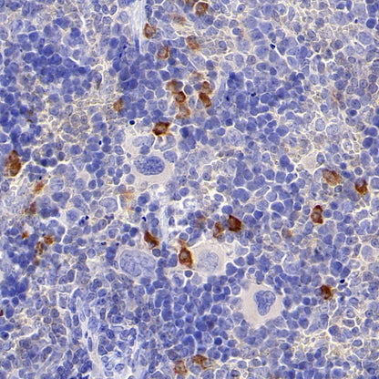 Mouse IL-6 Recombinant  mAb (S-1494-6)