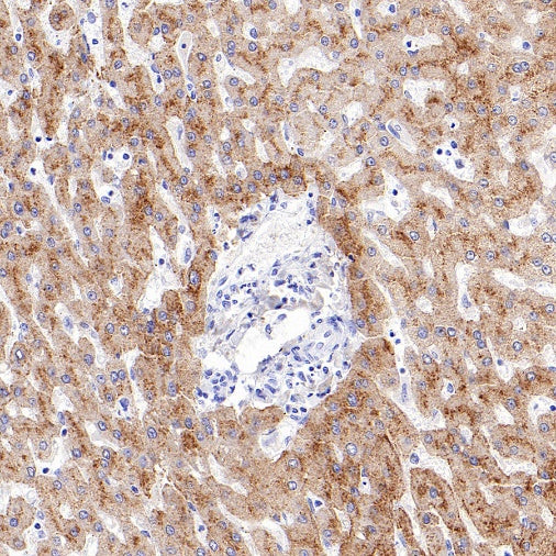 Transferrin Receptor 2/TFR2 Recombinant Rabbit mAb (S-1735-133)