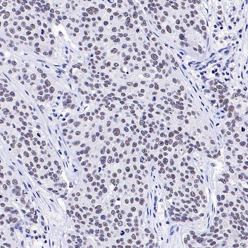 RNF40 Recombinant Rabbit mAb (S-1068-279)