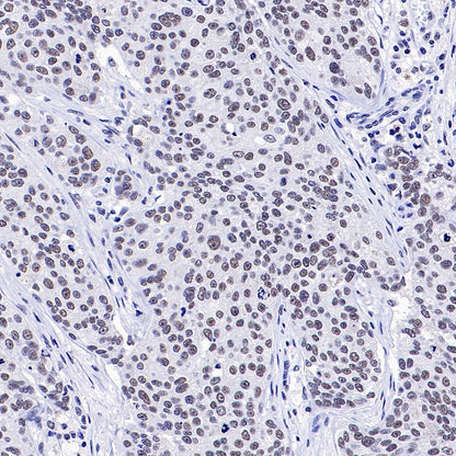 RNF40 Recombinant Rabbit mAb (S-1068-279)