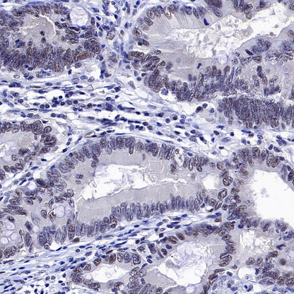 MLH1 Recombinant Mouse mAb,PBS Only (SDT-R702)