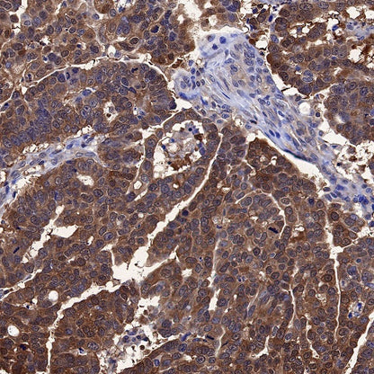 MIF Recombinant Rabbit mAb (S-1007-34)