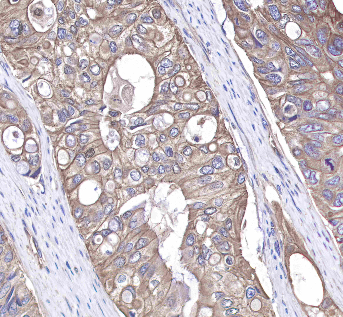 c-Met Rabbit mAb(SDT-009-7-2)