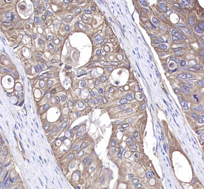 c-Met Rabbit mAb(SDT-009-7-2)