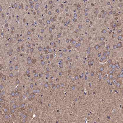 YWHAH/14-3-3 eta Recombinant Rabbit mAb (S-1327-22)
