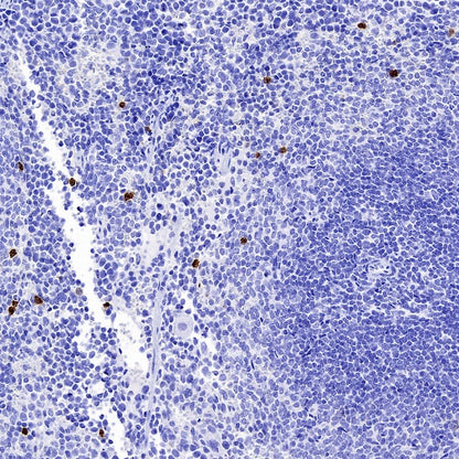 Olfm4 Recombinant Rabbit mAb (S-2748-67)