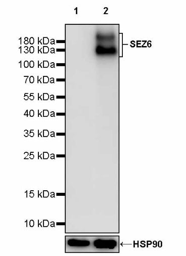 SEZ6 Recombinant Rabbit mAb (SDT-2097-7)