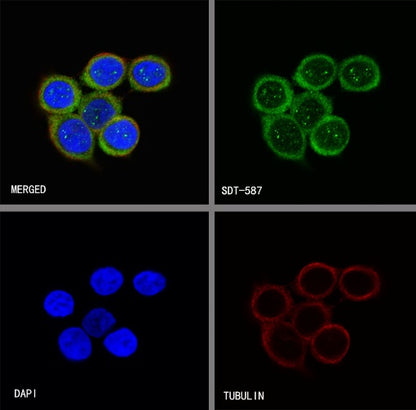 RRM1 Recombinant Rabbit mAb (S-587-21)