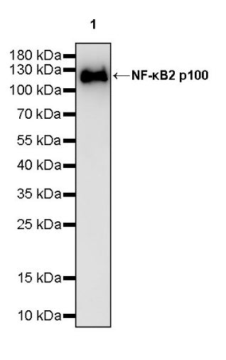 NF-κB2 p100 Recombinant Rabbit mAb (S-2502-62)