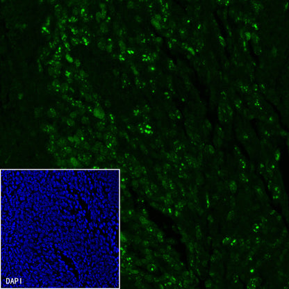 Ki67 Recombinant Mouse mAb (SDT-606-7)