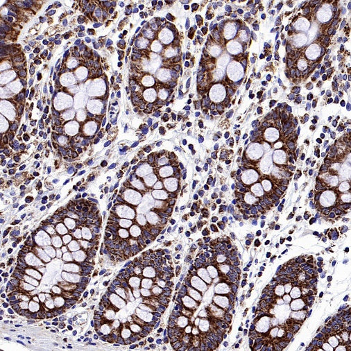 TOMM40 Rabbit Polyclonal Antibody