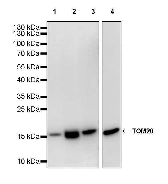 TOM20 Recombinant Rabbit mAb (S-M0015)