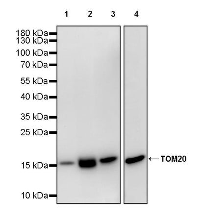 TOM20 Recombinant Rabbit mAb (S-M0015)