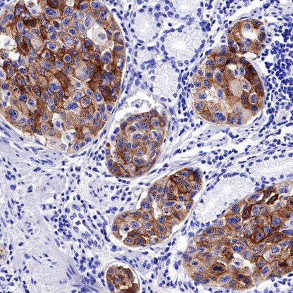S-RMab® FGFR2b Recombinant Rabbit mAb (SDT-423-33)