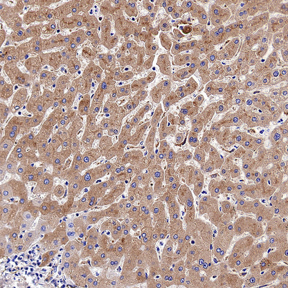 C3 Recombinant Rabbit mAb (S-5146)