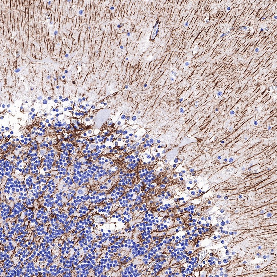 GFAP Recombinant Rabbit mAb (SDT-306-10)