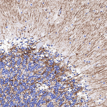 GFAP Recombinant Rabbit mAb (SDT-306-10)
