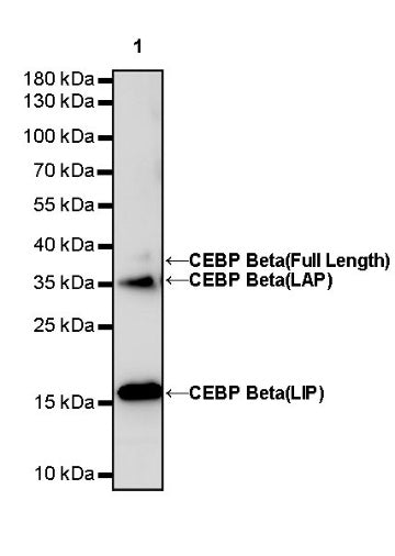 CEBP Beta (C-terminal) Recombinant Rabbit mAb (S-773-48)