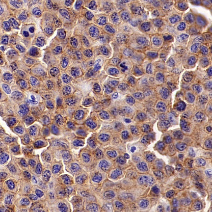 LY9/CD229 Recombinant Rabbit mAb (SDT-2393-47)