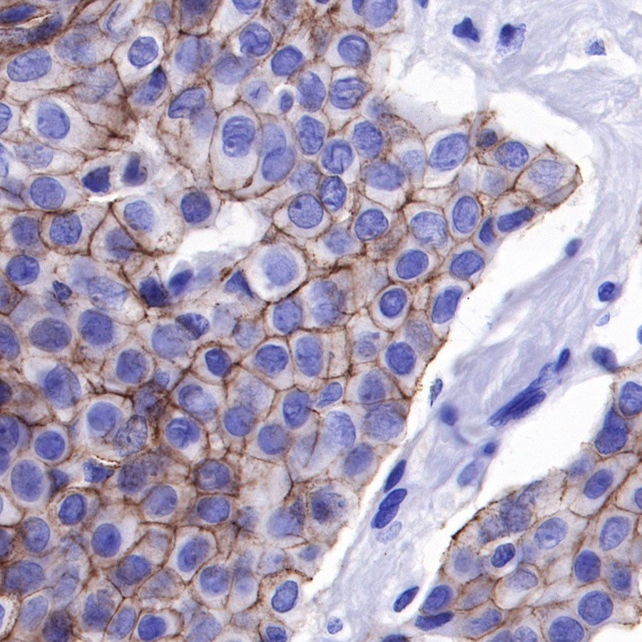 Nectin-4 Recombinant Rabbit mAb (SDT-277-229)
