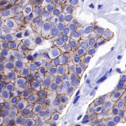 Nectin-4 Recombinant Rabbit mAb (SDT-277-229)
