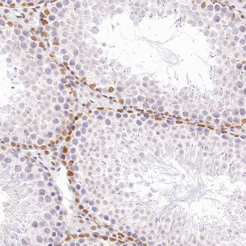 HDAC3 Recombinant Rabbit mAb (S-1977-31)