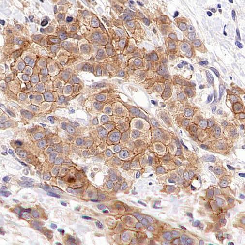 GDNF Receptor alpha 1/GFRA1 Recombinant Rabbit mAb (S-3289-52)