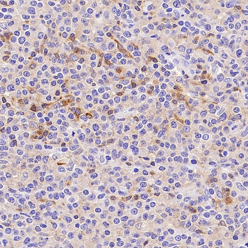Jak3 Recombinant Rabbit mAb (S-4219)