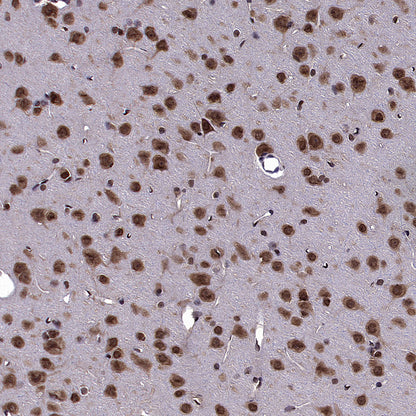CNBP Recombinant Rabbit mAb (S-4288-3)