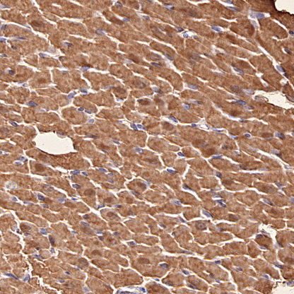 Myoglobin Recombinant Rabbit mAb (S-6197)