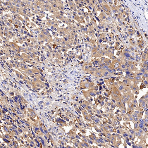 Cathepsin B Recombinant Rabbit mAb (S-1067-7)