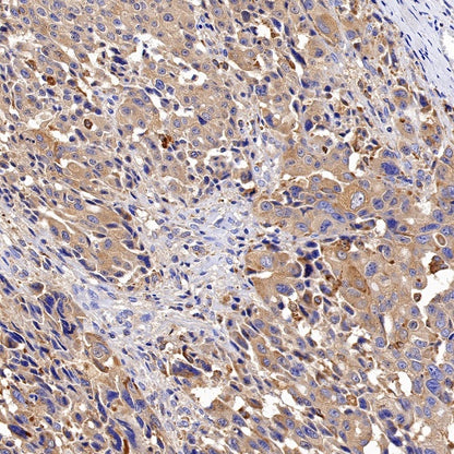 Cathepsin B Recombinant Rabbit mAb (S-1067-7)