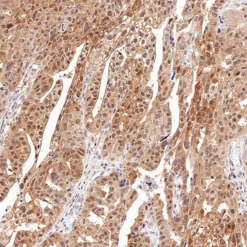 PSME1 Recombinant Rabbit mAb (S-732-14)