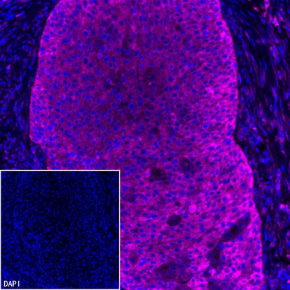 PABP Recombinant Rabbit mAb (S-1744-42)